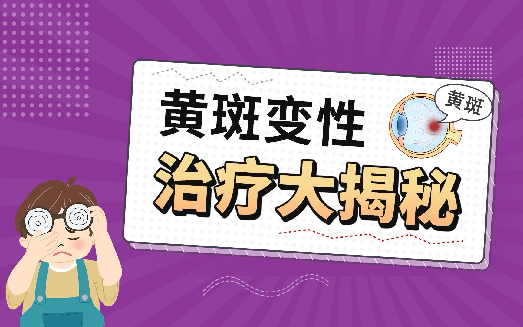 黄斑变性是三大致盲性眼病之一,有没有什么好的治疗方法呢?来听听马叔怎么说~哔哩哔哩bilibili