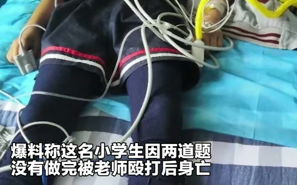 网曝四川一小学生因题没做完被老师殴打致死教育局已介入调查