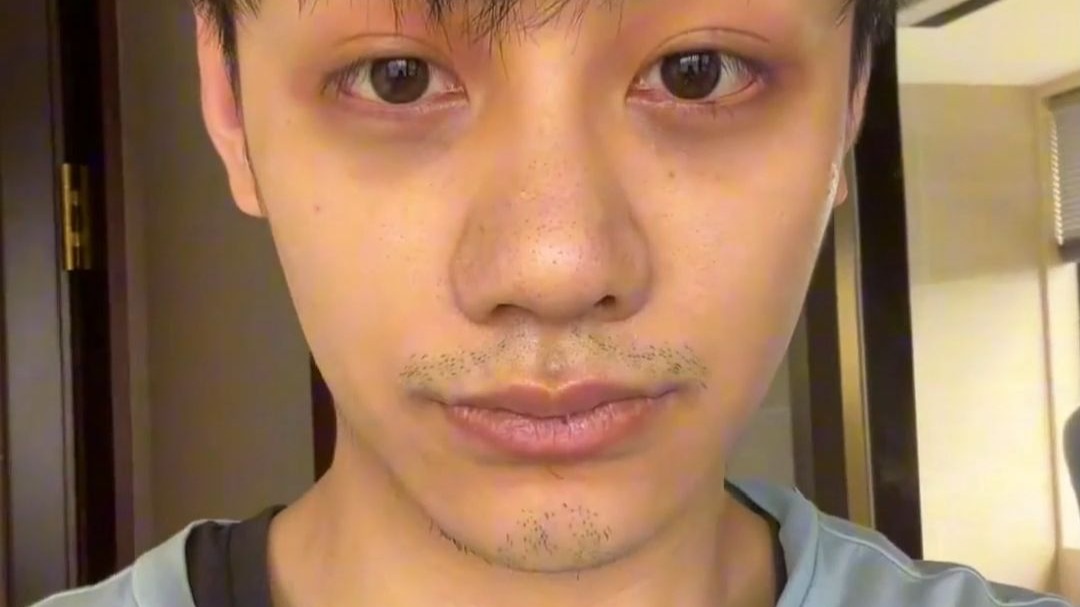 肾虚的男人有什么特征