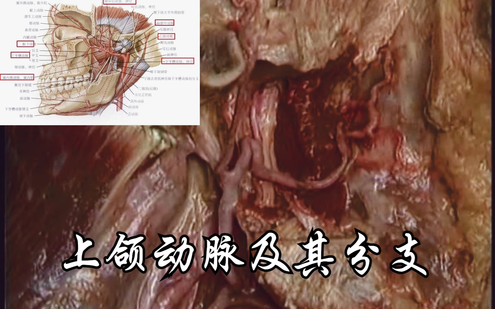 上颌动脉及其分支哔哩哔哩bilibili