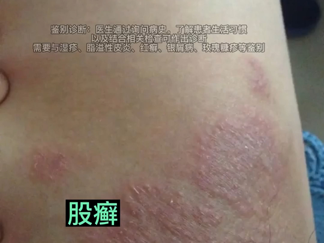 男人私处好伴侣,让你清爽无臭味