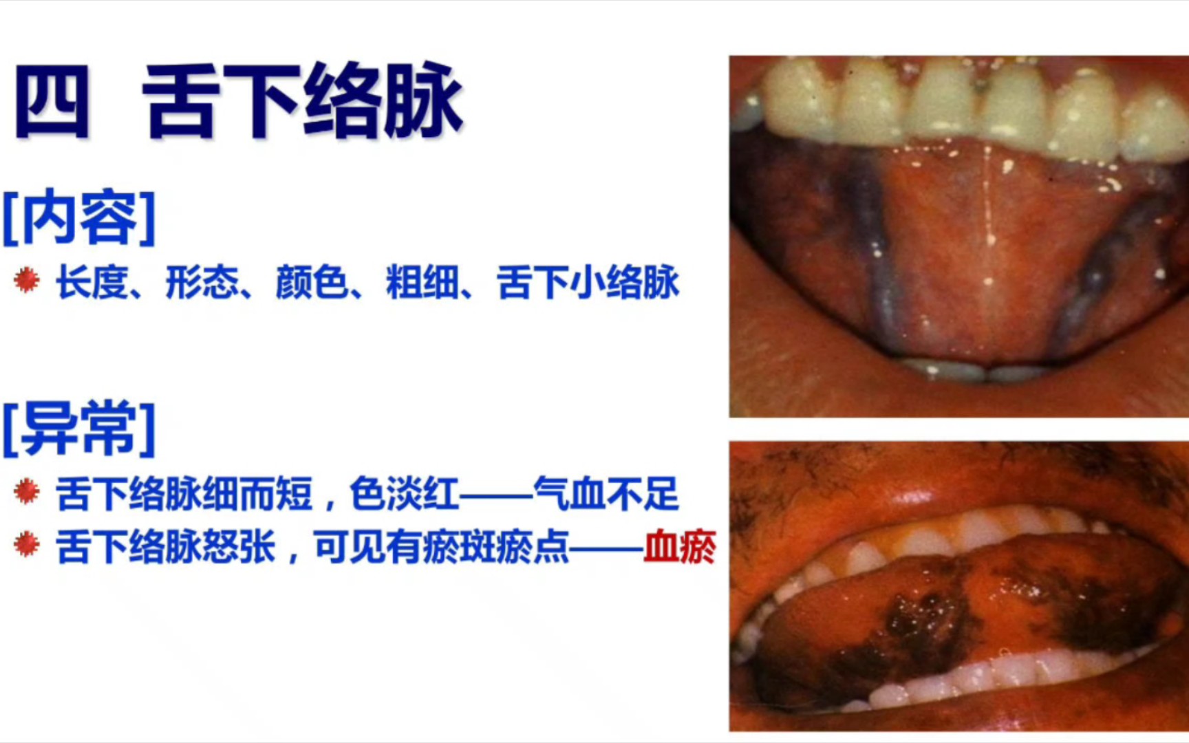 舌下经络图片