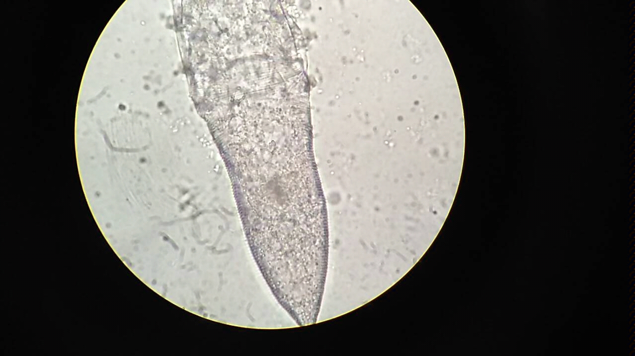 【科普】当兽医的时候拍的显微镜下的螨虫【显微镜】显微镜下的辣条