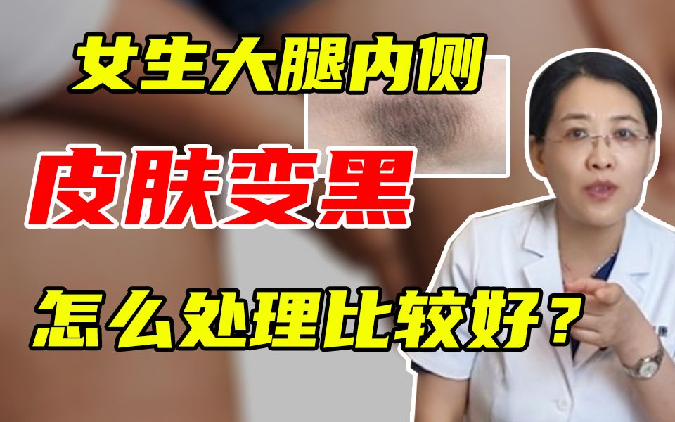 [图]女生大腿内侧皮肤变黑，怎么处理比较好？