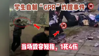 Download Video: 学生自制“GPR”炸膛事件，当场毁容断指，1死4伤，太惨了