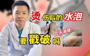 Download Video: 烫伤后的水泡几天消除，要戳破吗？各有利弊分两种情况