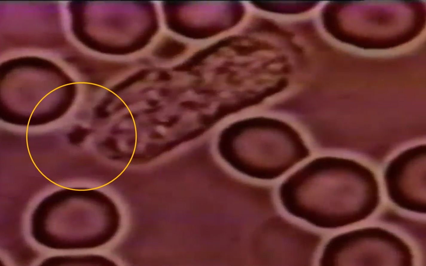 震撼5分钟:放大1000倍,看看你身体里的白细胞如何追杀体内细菌病毒?