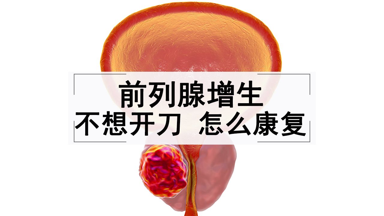 前列腺增生除了做手术外,还有其他治疗方法吗?