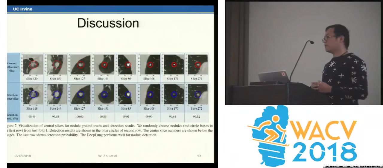 WACV18  DeepLung  Deep 3D Dual Path Nets for Automated Pulmonary Nodule Detect哔哩哔哩bilibili