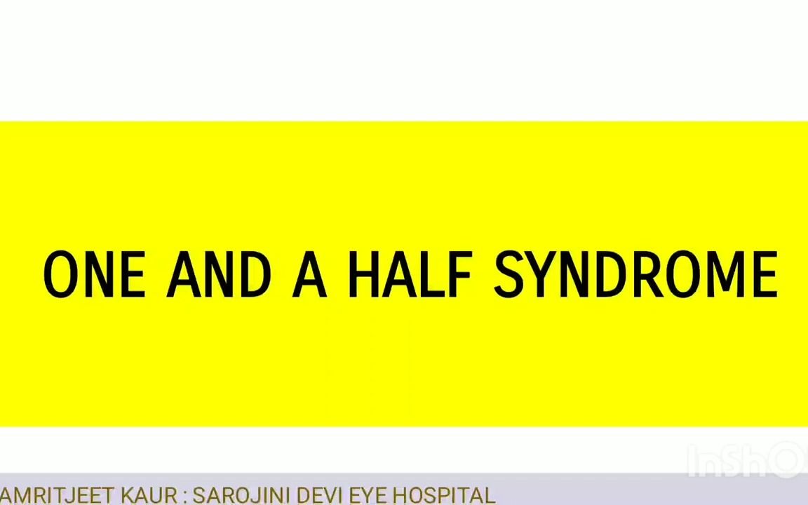 What is One and Half Syndrome  一对半综合征哔哩哔哩bilibili