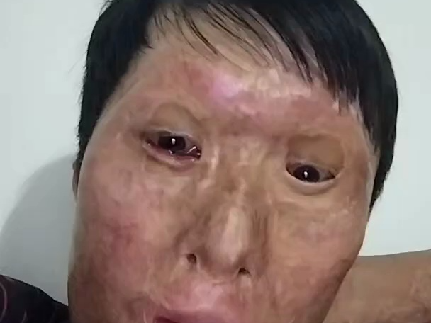 5.12 烧伤易哥 5——中国男主播年鉴