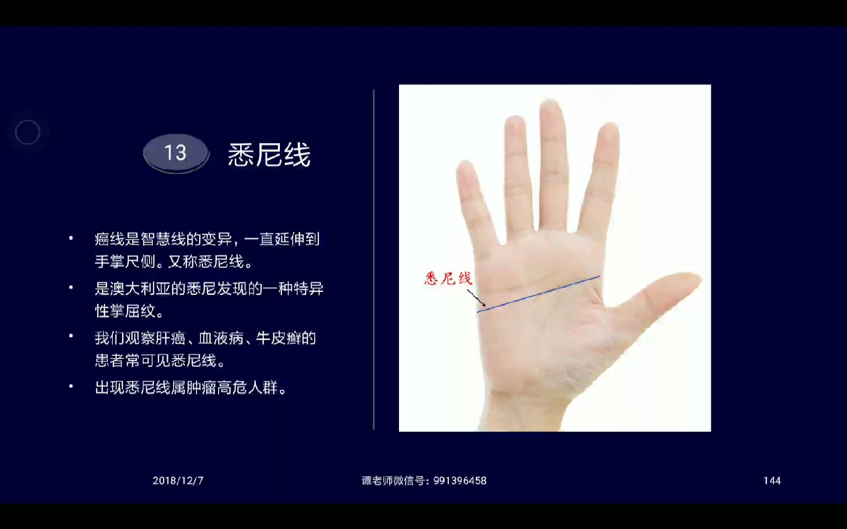 19.手诊掌纹诊法:悉尼线,五种特殊纹～(谭奕丰老师2017年线上培训版)