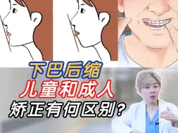 Download Video: 义乌正畸丨下巴后缩怎么办？儿童和成人矫正方案大不同！