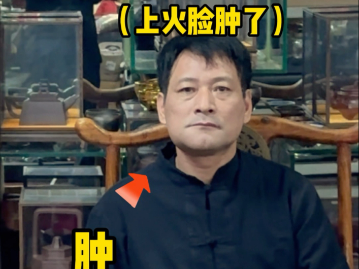 哦豁，老爸脸肿了