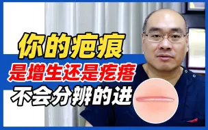 Video herunterladen: 你的疤痕是增生还是瘢痕疙瘩？不会分辨的？这个视频要看完