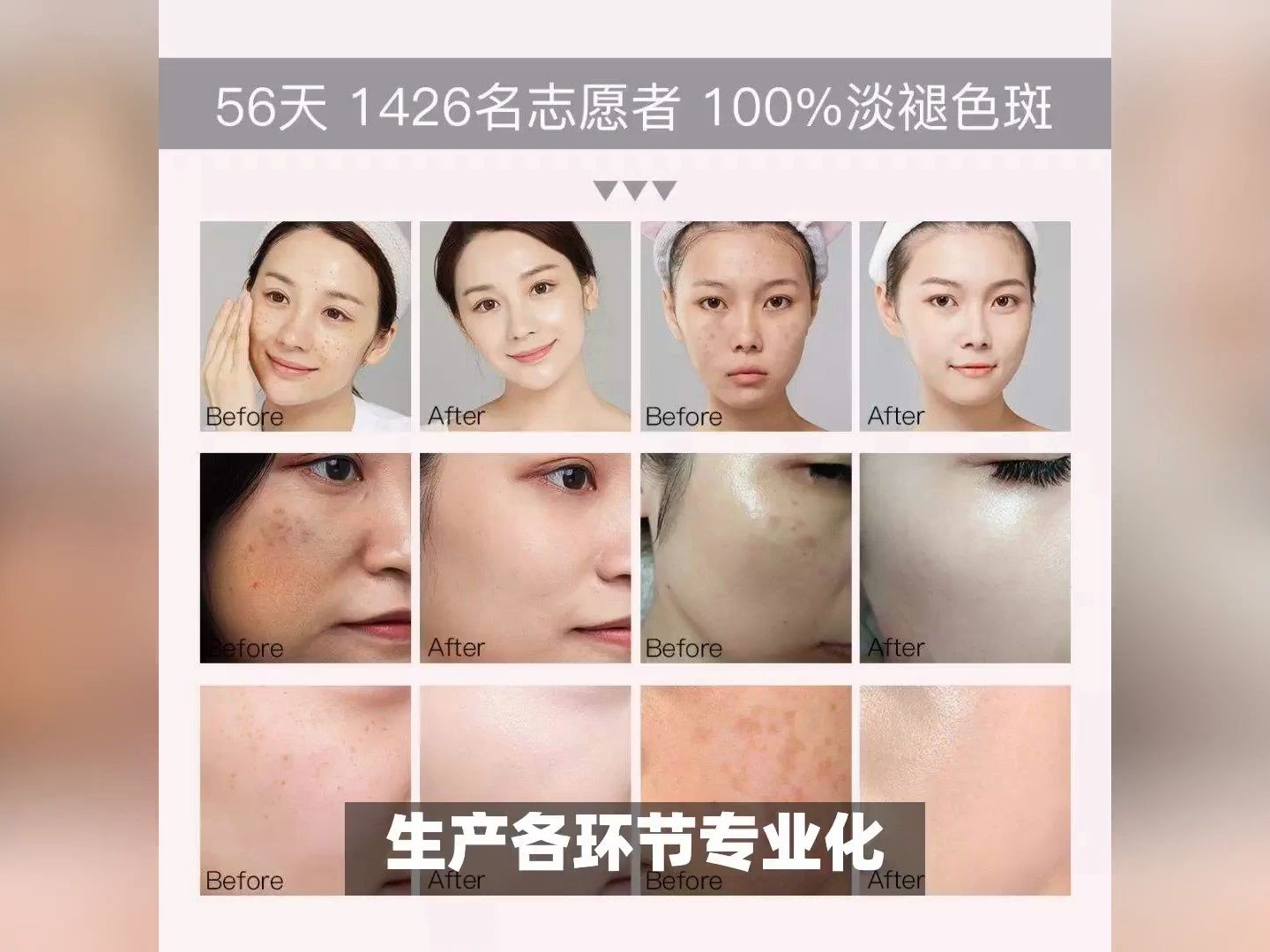 淡斑美白效果好的护肤品,祛斑效果排名第一