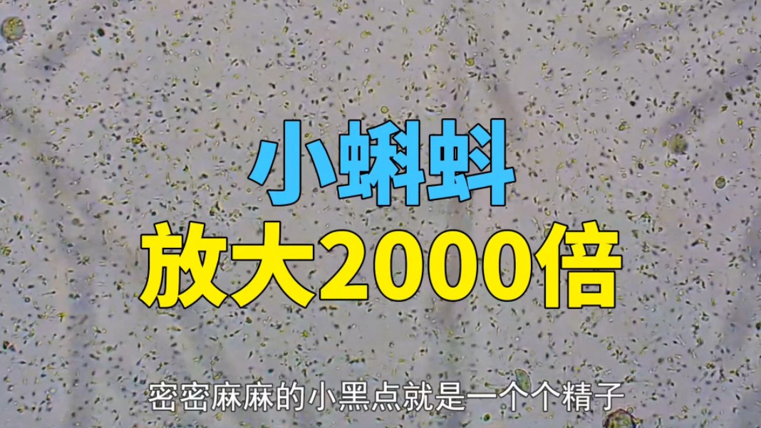 小蝌蚪放大2000倍看,原来我孩子长这样哔哩哔哩bilibili