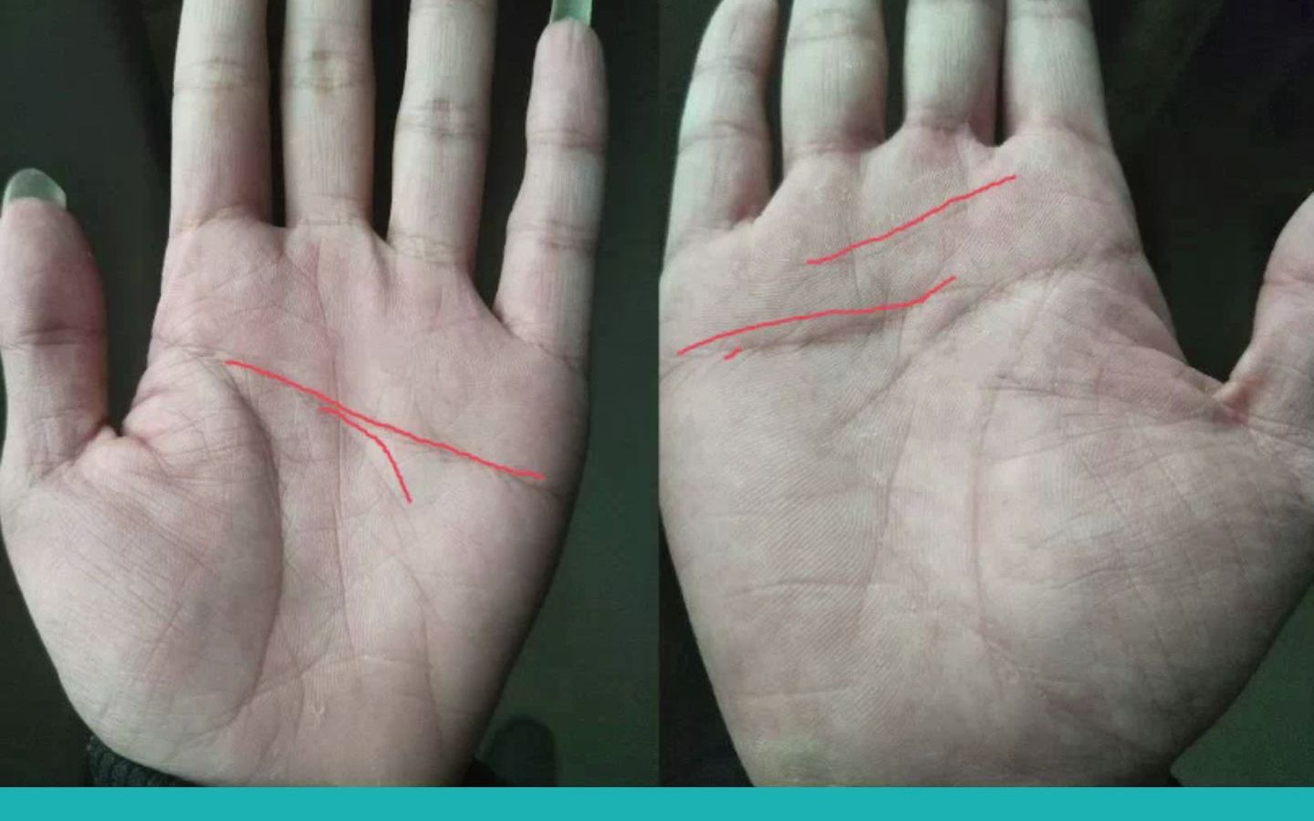 感情线下有羽毛纹会出轨吗 婚姻情况怎么样