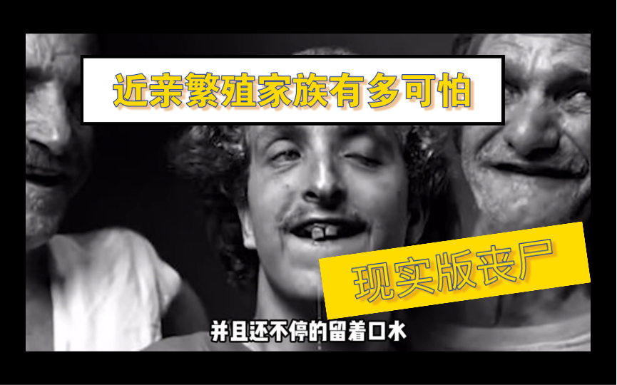 最恐怖近亲繁殖家族:面部畸形只会犬吠,智力低下行为怪异