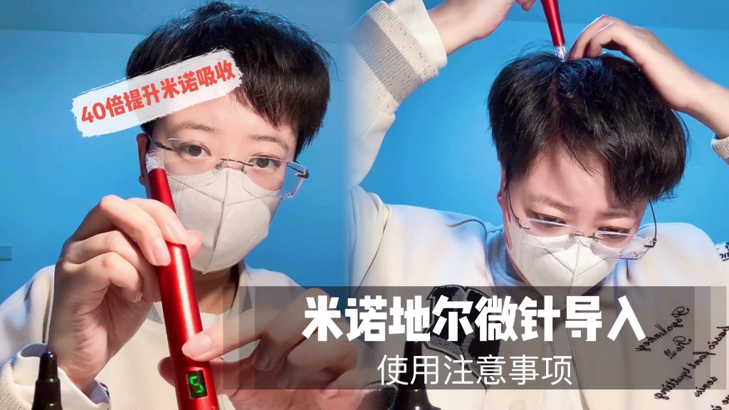 米诺地尔微针导入注意事项