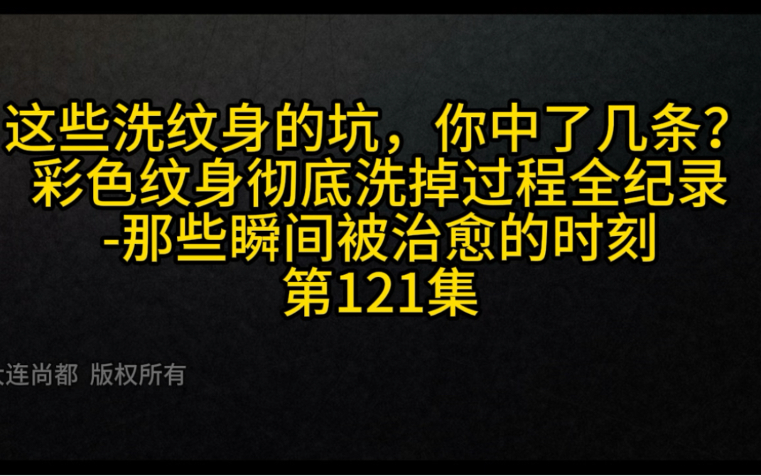 彩色紋身能徹底洗乾淨嗎-一半在險境,一半在人間#超皮秒洗紋身#胡歌