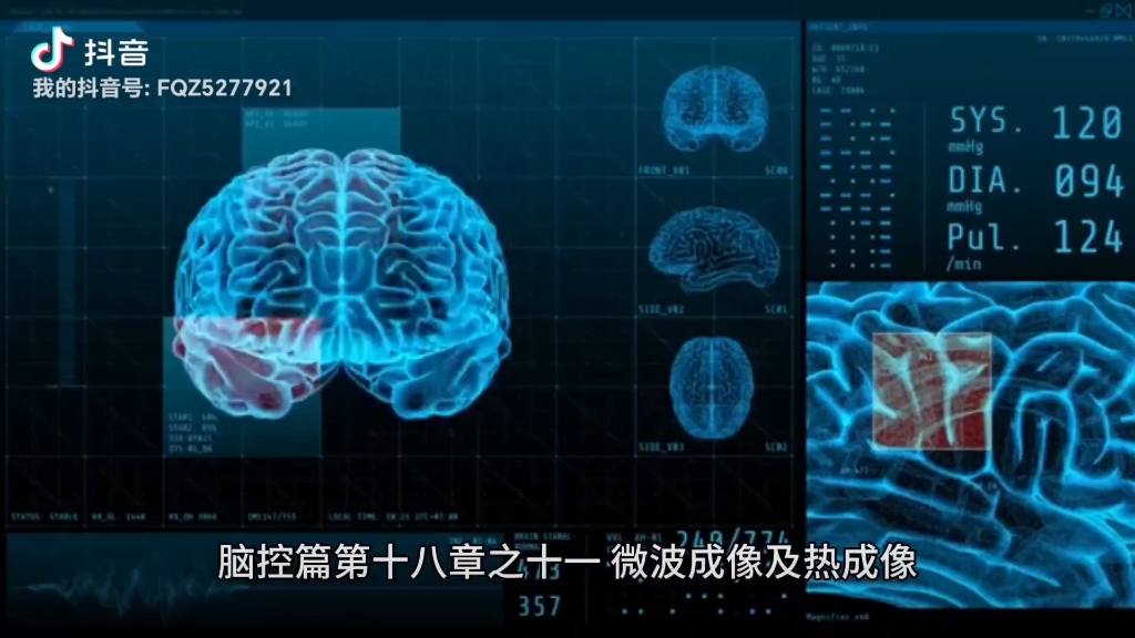 [图]脑控篇微波成像系统热成像系统无线射频成像系统 功能与知识