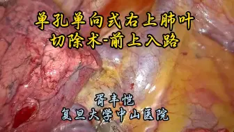单孔单向式右肺上叶癌根治术（前上入路） 胥丰恺教授供稿