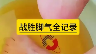 Tải video: 战胜脚气全记录，快速击退脚气！