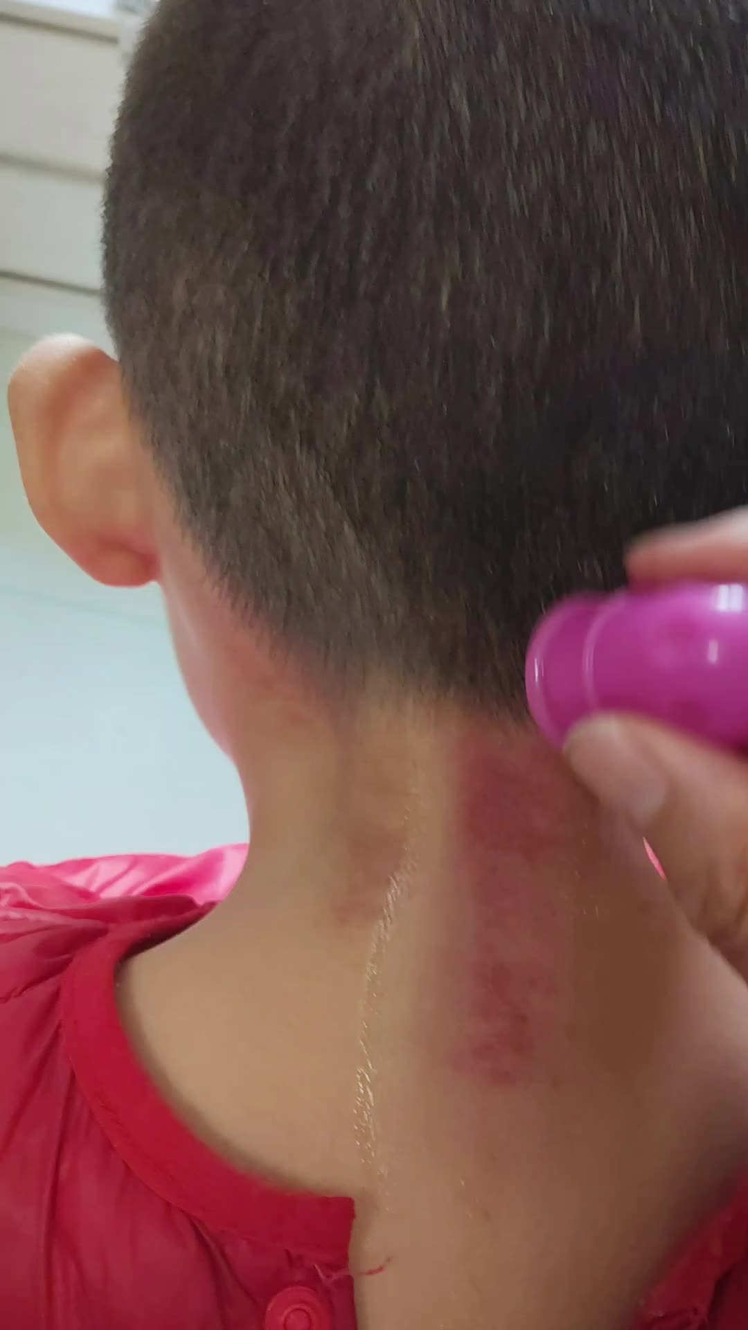 小朋友背部刮痧教程