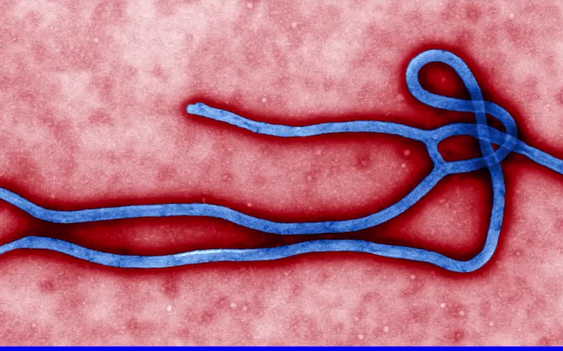 苏丹埃博拉病毒图片