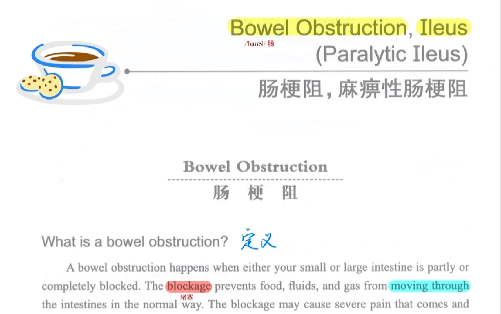 肠梗阻|医学英语文章朗读,好好听哦!哔哩哔哩bilibili