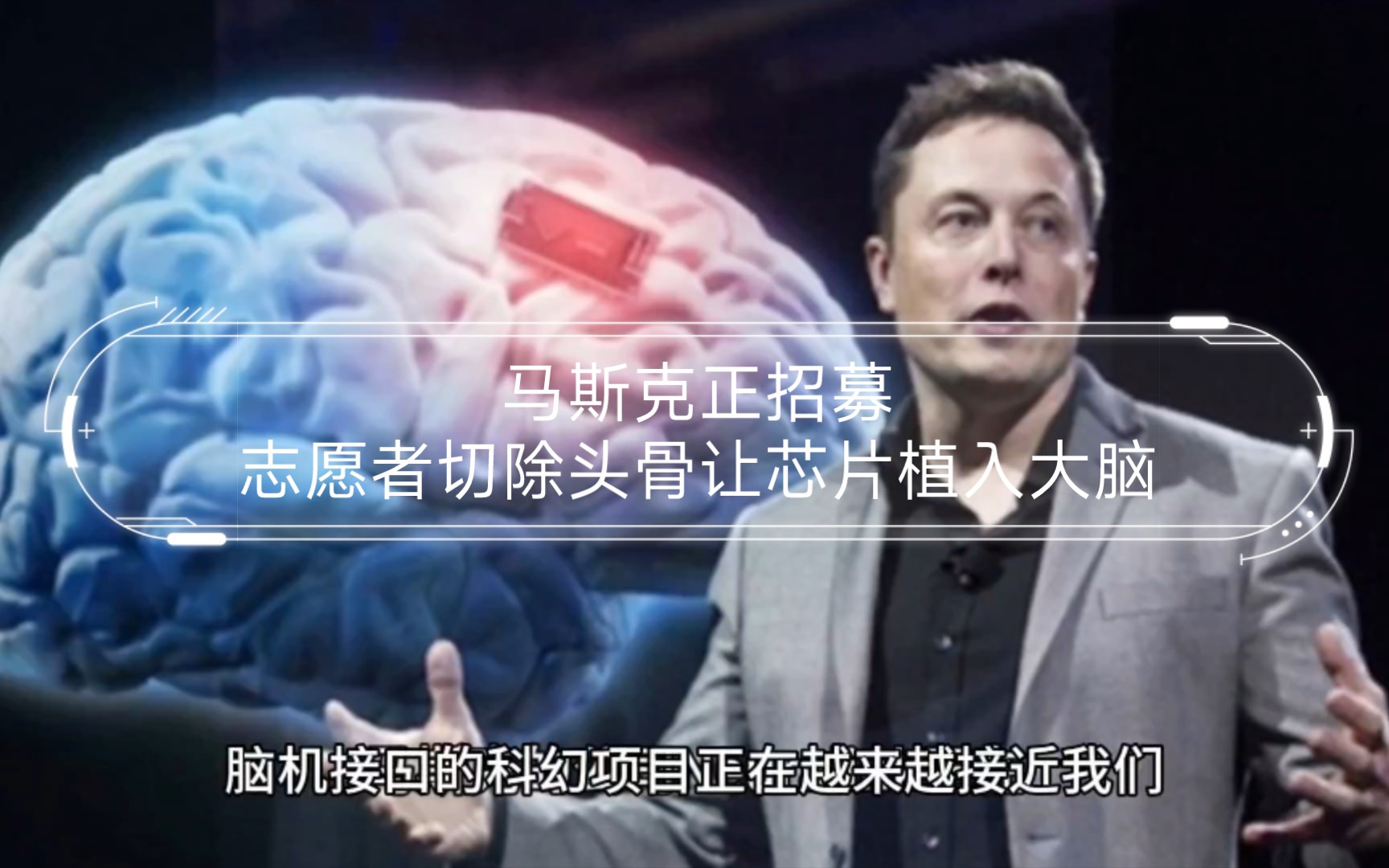 马斯克正招募志愿者切除头骨让芯片植入大脑