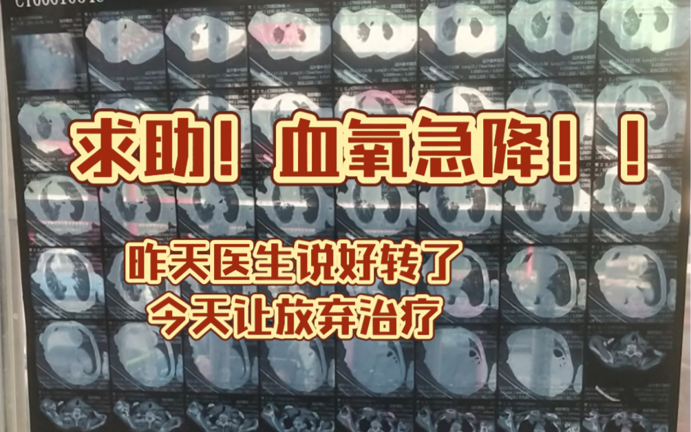 昨天复查医生说好转了,今天就让放弃治疗,血氧降到89%,92岁姥姥,持续发烧,到底该怎么治疗啊哔哩哔哩bilibili