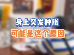 Descargar video: 身上突然肿胀、长风团，那叫一个痒，别挠听听皮肤科主任怎么说#科普 #荨麻疹 #痒 #过敏