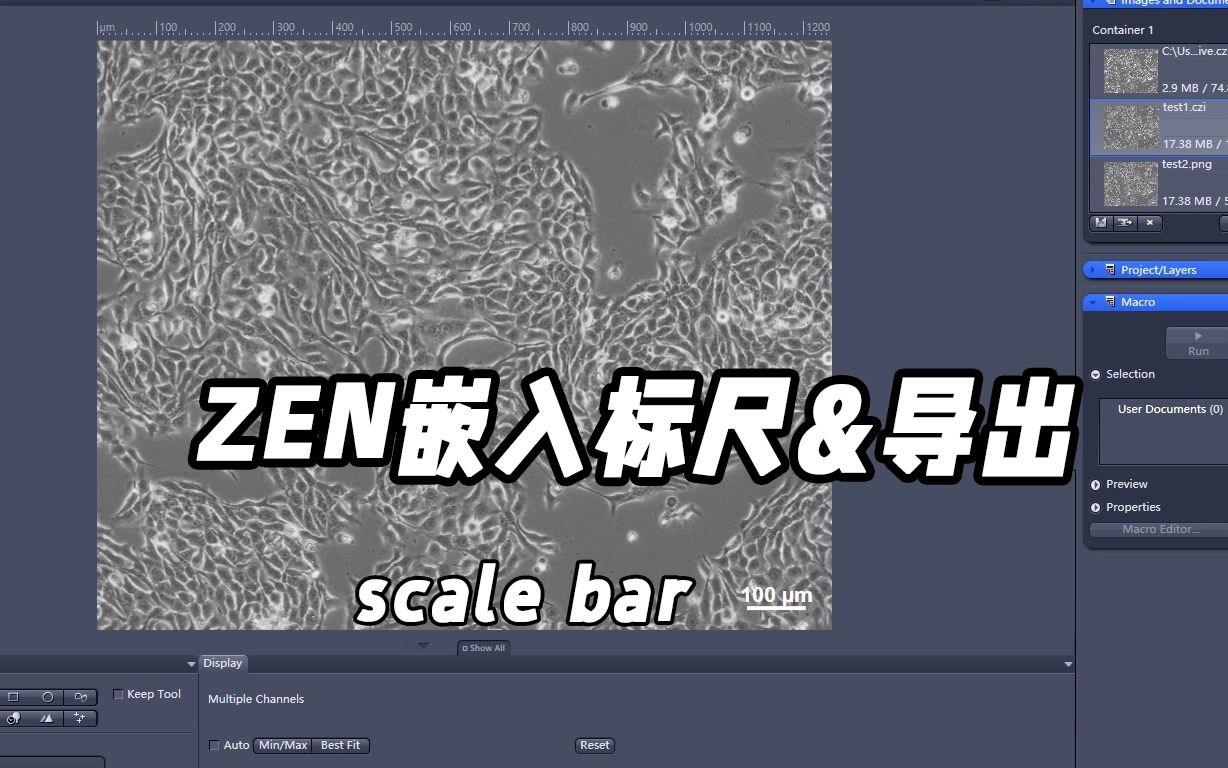 使用蔡司显微镜软件ZEN对图像嵌入标尺scale bar - 视频下载 Video Downloader