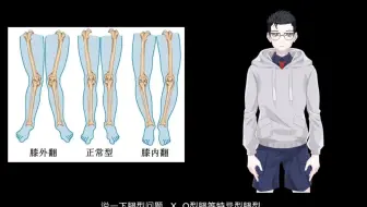 发兔冷知识 那么多日本妹子的o型腿都是怎么来的 哔哩哔哩 Bilibili