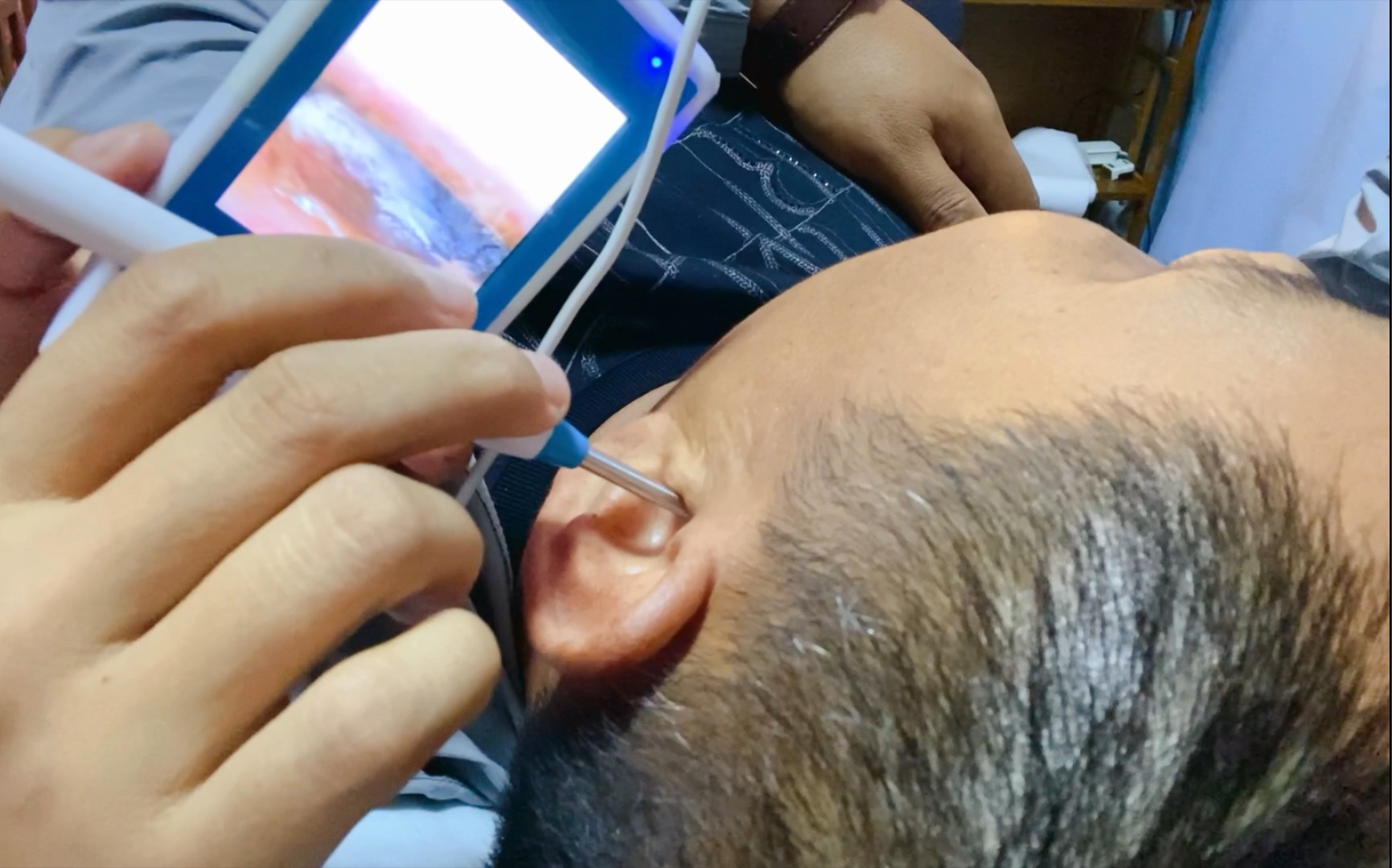 釆耳的故事之来北京出差耳朵不舒服