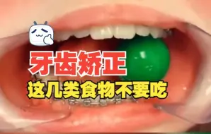 Descargar video: 牙齿矫正，这几类食物不要吃