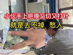 Télécharger la video: 手上的结的痂不要手欠抠，留疤后小伙又是打针又是切