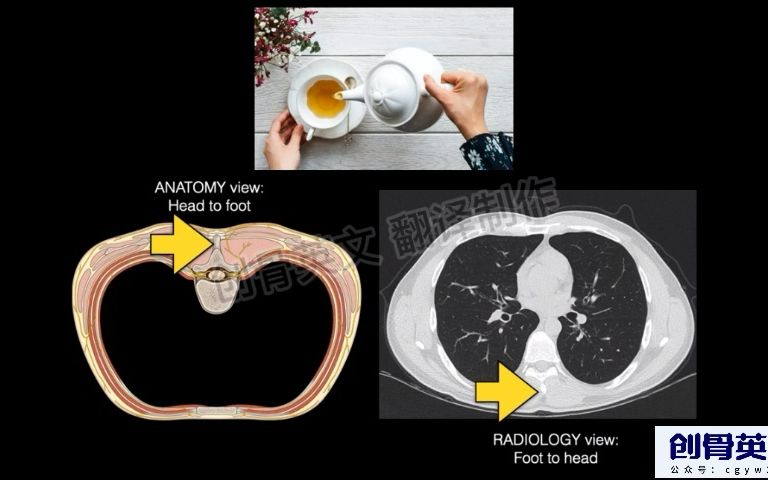 胸部CT解剖常识哔哩哔哩bilibili