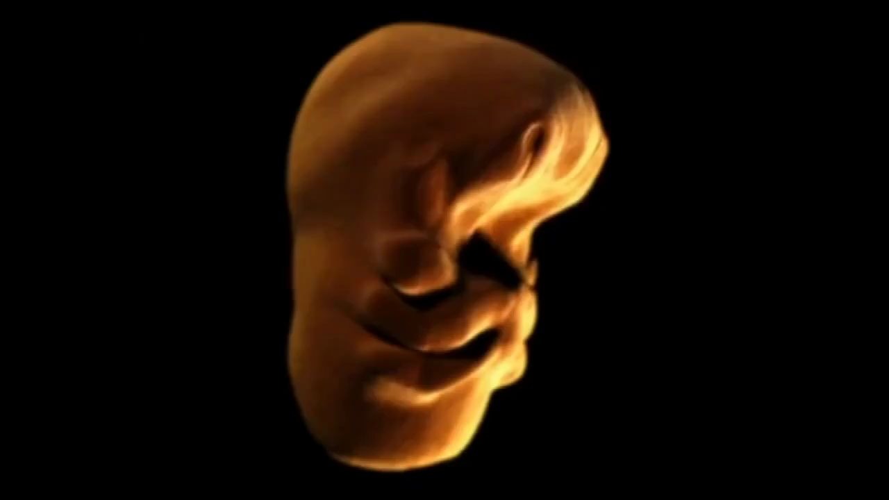 胎儿在子宫里的面部变化过程每个五官的形成都出乎意料