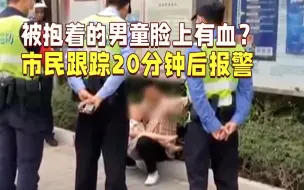 Download Video: 被抱着的3岁男童脸上有血？热心市民跟踪20分钟后报警