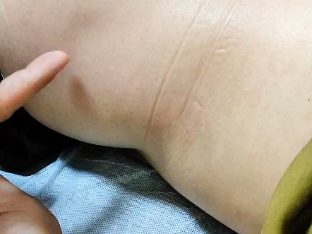 女性腰部中间凹进去图片