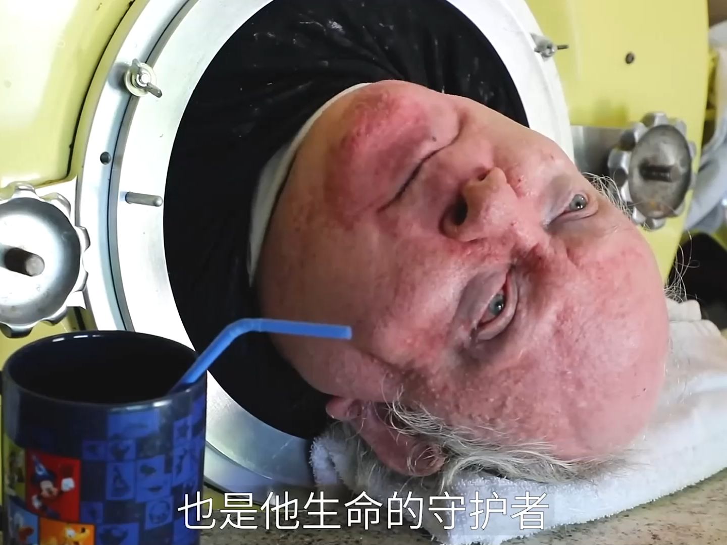 "困"在铁桶里70多年的男人,是目前世界上最久的"铁肺人" #知识科普