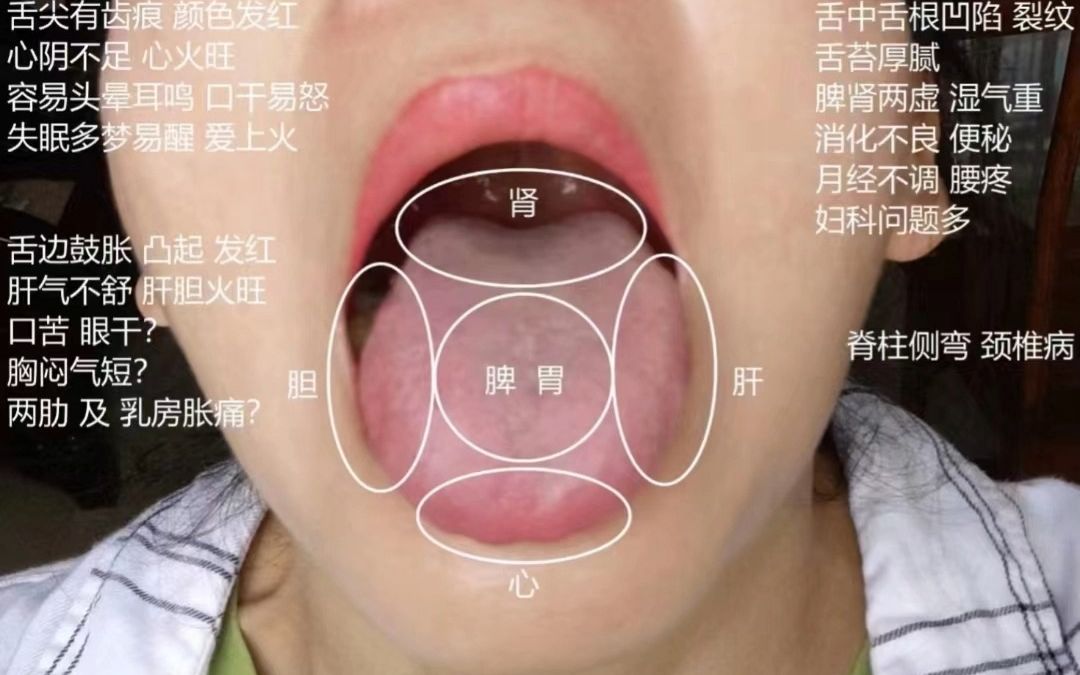 [图]舌诊学会，少往医院跑！