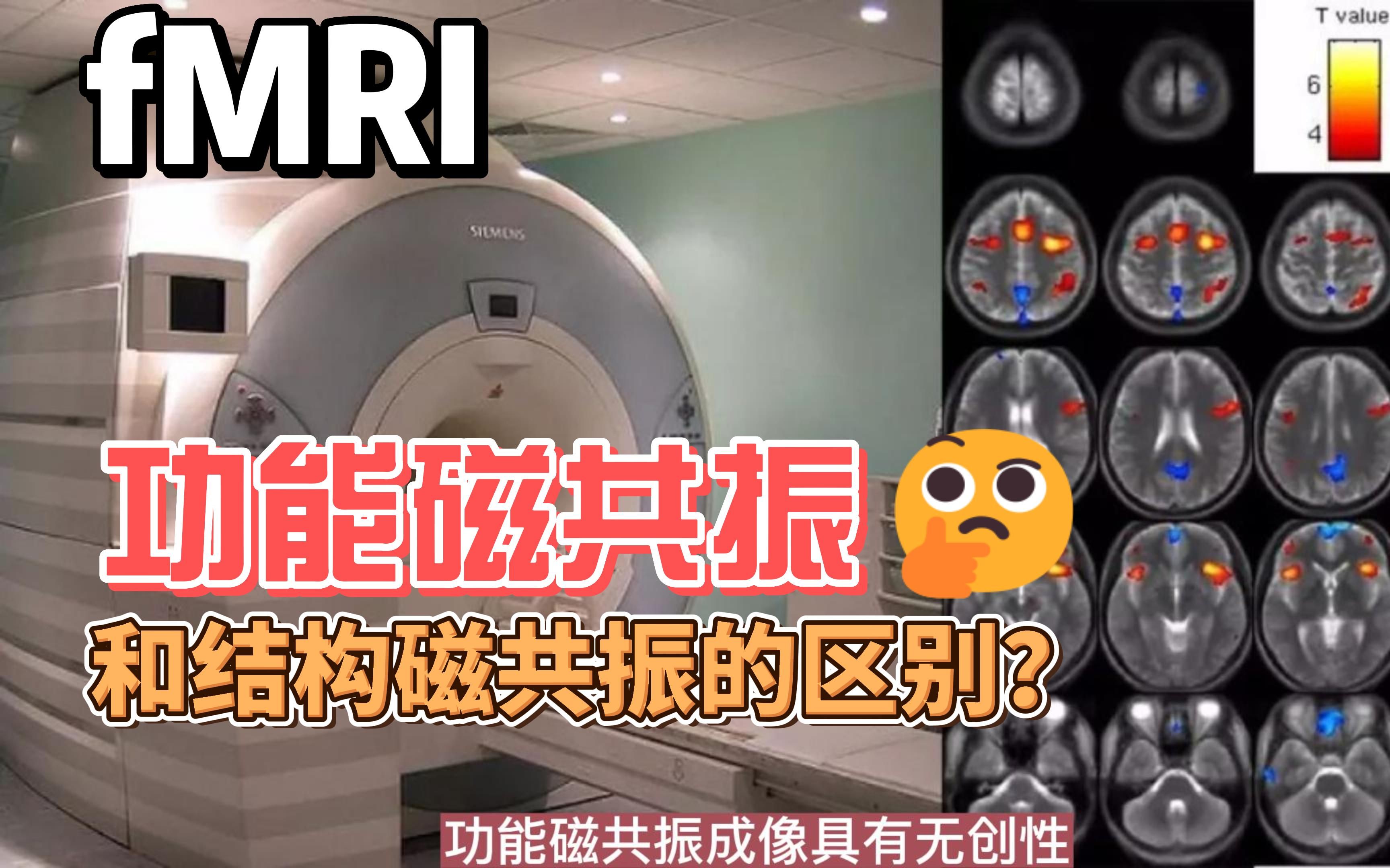 【基础知识】什么是功能磁共振fMRI,和结构像MRI区别是什么?平面回波成像(EPI)是什么?哔哩哔哩bilibili