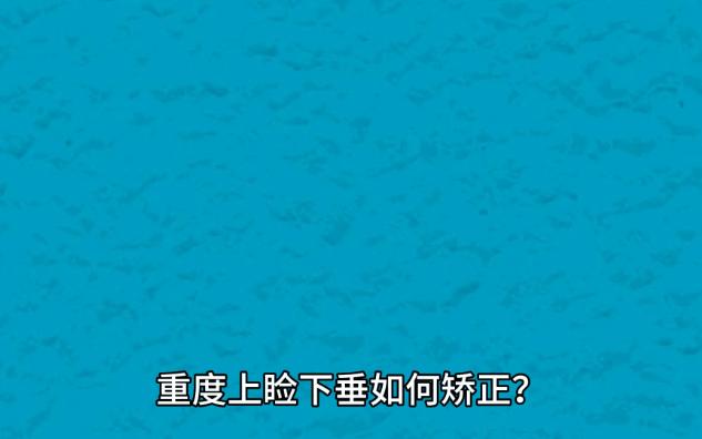 重度上睑下垂如何矫正?近30年眼整形经验孔宇医生,告诉大家这几点很重要.哔哩哔哩bilibili