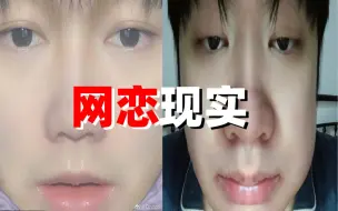 Télécharger la video: 19号永失我猪，BLUE去拔牙了也太可爱啦哈哈哈哈