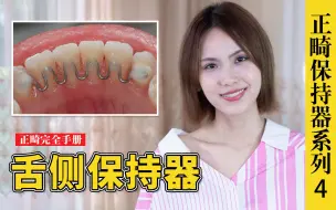 Tải video: 舌侧保持器，绝对隐形和牙周健康不可兼得？