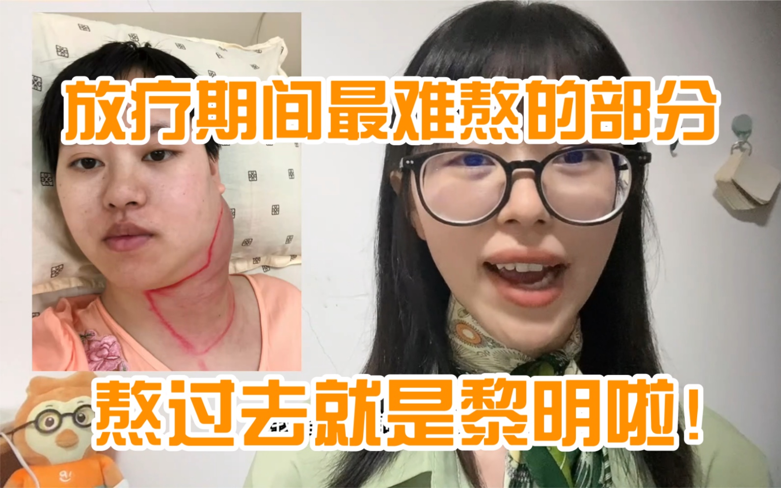 放疗期间最难熬的部分,熬过去就是黎明啦 | 抗癌记录 | 08 放疗副作用哔哩哔哩bilibili